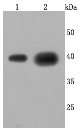 Cathepsin LVKH Antibody