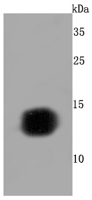 Hemoglobin subunit gamma 1and2 Antibody