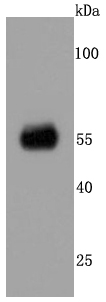 CaMKII alpha Antibody