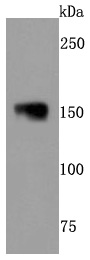 NEFM Antibody