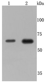 TNF Receptor II Antibody