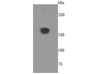 A2M Antibody