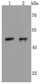 NeuroD1 Antibody