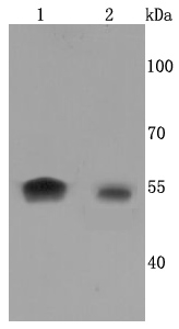 Aromatase Antibody