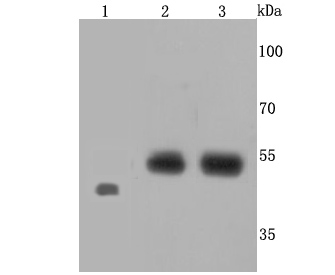 Endothelin B Receptor Antibody