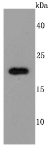 TIMP2 Antibody