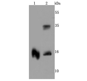 TTR Antibody