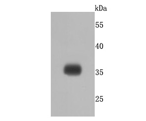 delta Sarcoglycan Antibody
