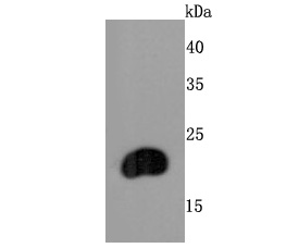 FGF21 Antibody