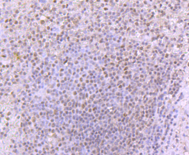 53BP1 Antibody
