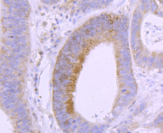 Vitamin D Receptor Antibody