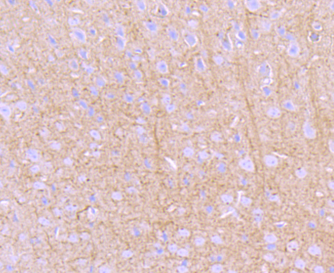 PKA 2 beta (regulatory subunit) Antibody