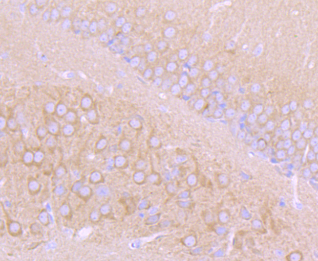 Choline Acetyltransferase Antibody