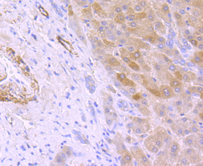 Hepcidin Antibody