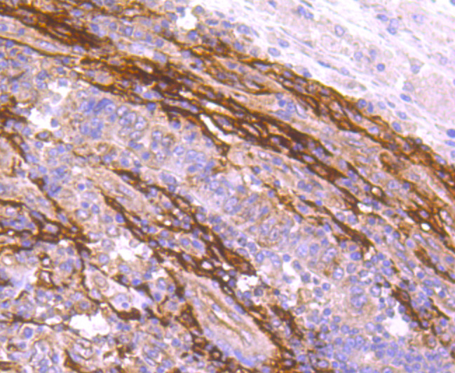 FAP1 Antibody