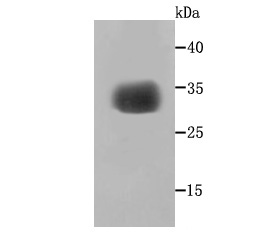 gamma Sarcoglycan Antibody