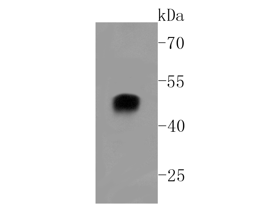 alpha sarcoglycan Antibody