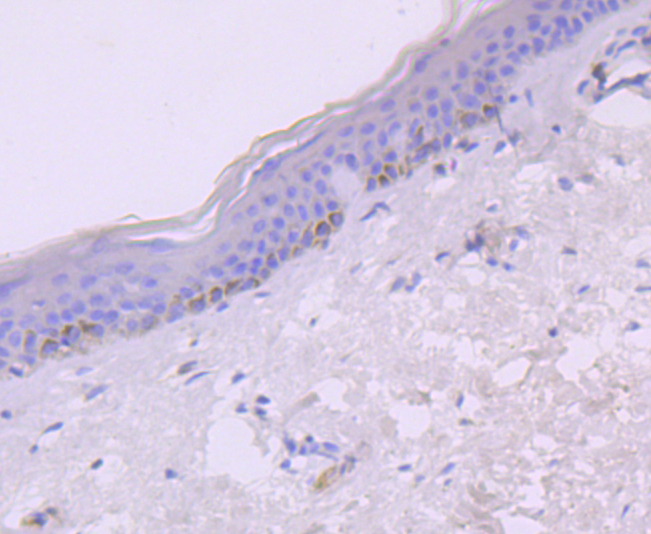 IP10 Antibody