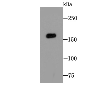 MSH6 Antibody