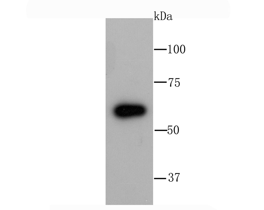 Glucose 6 Phosphate Dehydrogenase Antibody