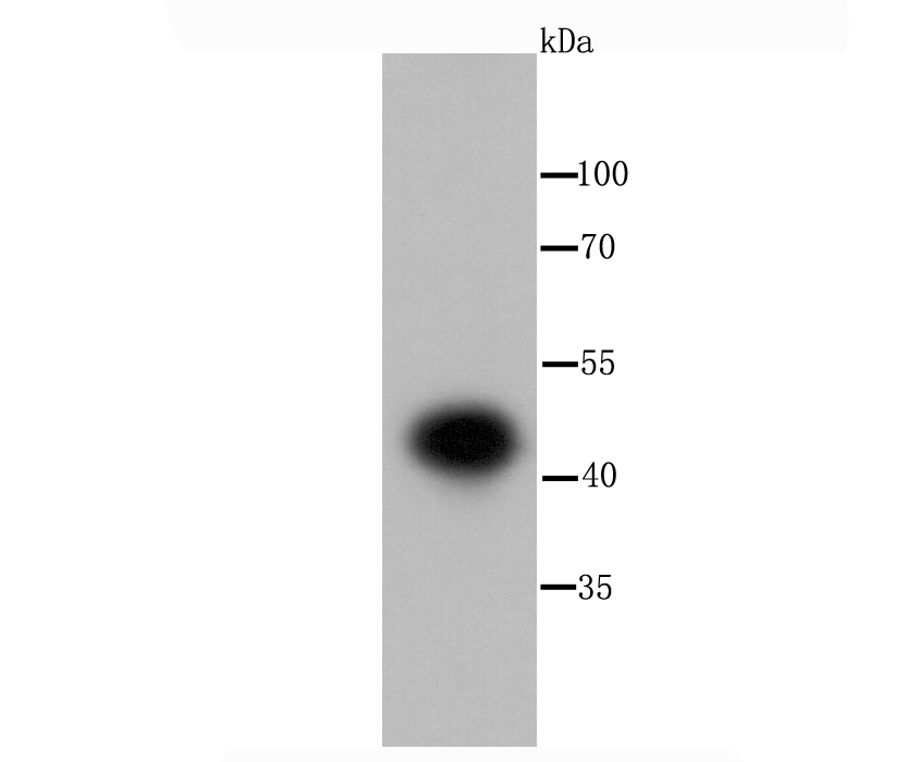 IKK gamma Antibody