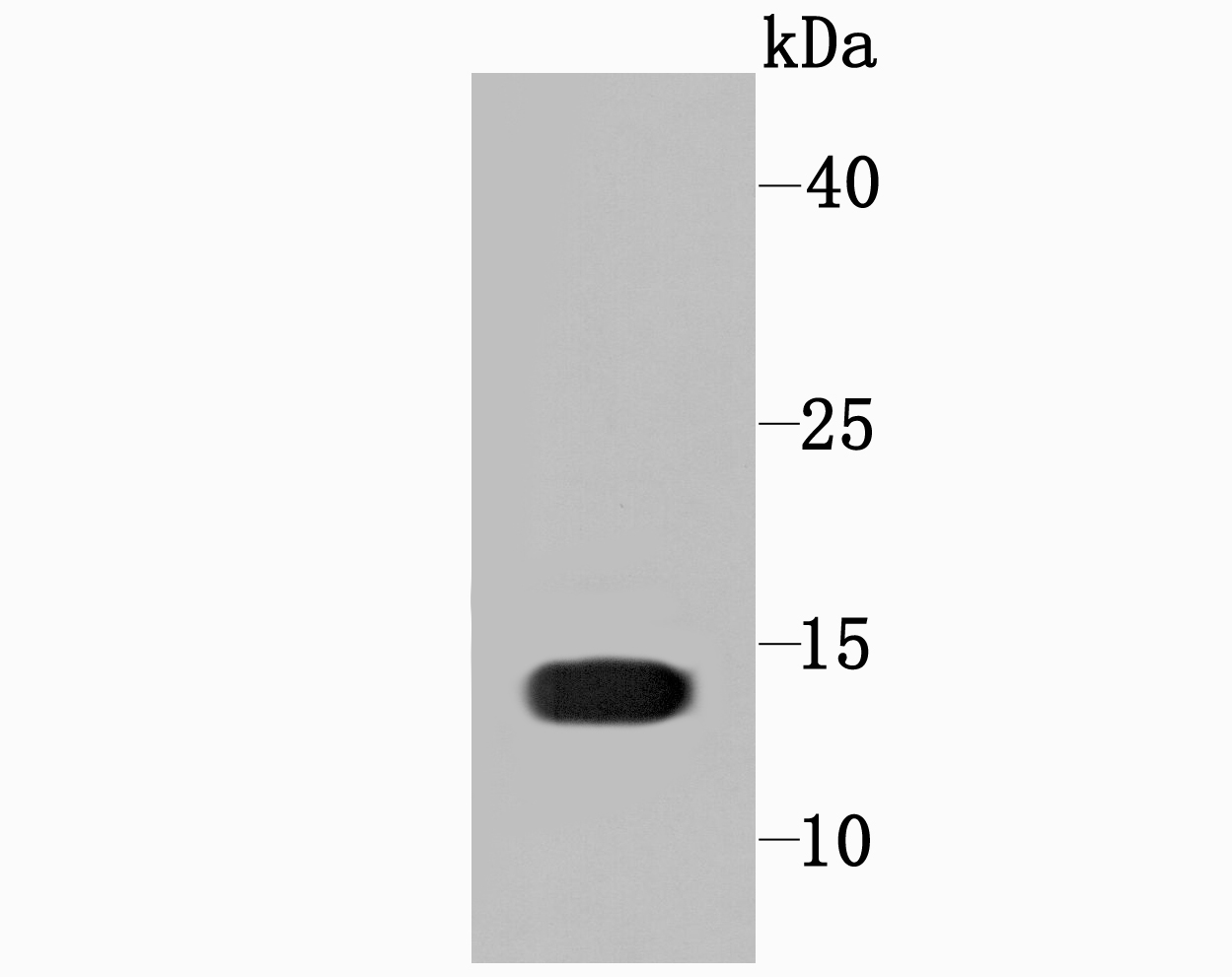 Profilin 1 Antibody