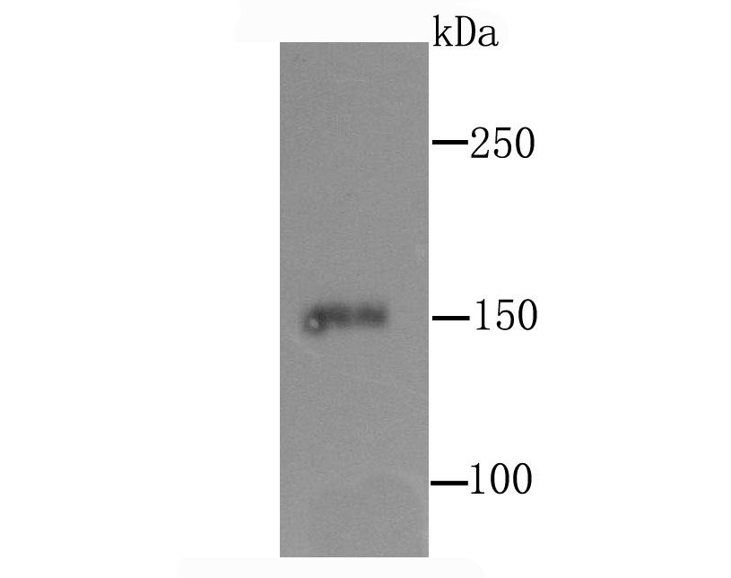 CD163 Antibody