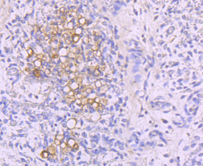 NFAT2 Antibody