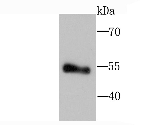 Lipoprotein lipase Antibody