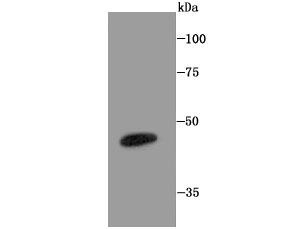 LXR alpha Antibody