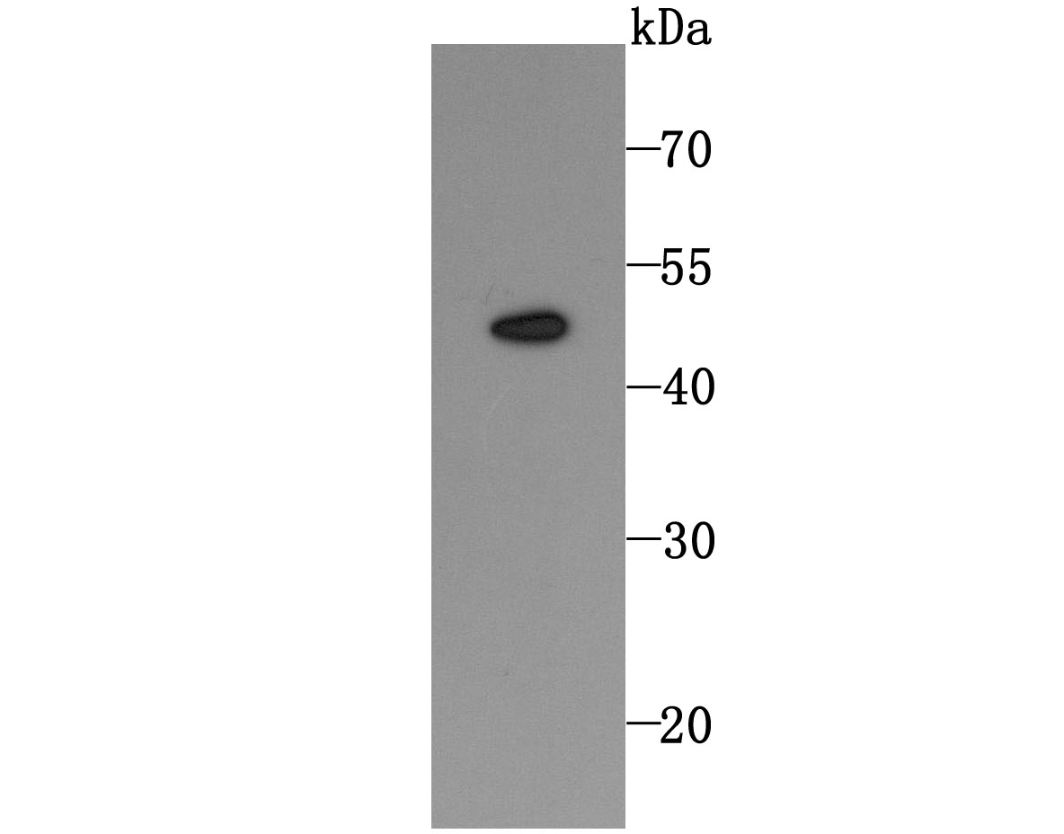DR5 Antibody