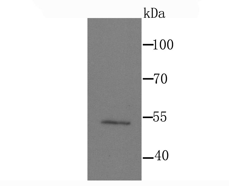 MEF2A Antibody