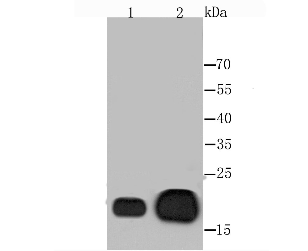 Alpha B Crystallin Antibody