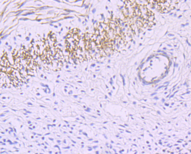 smooth muscle Myosin heavy chain 11 Antibody