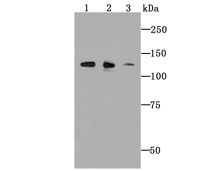 ULK1 Antibody