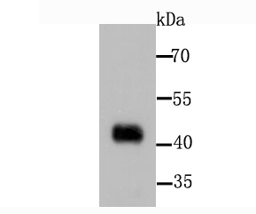 PDK1 Antibody