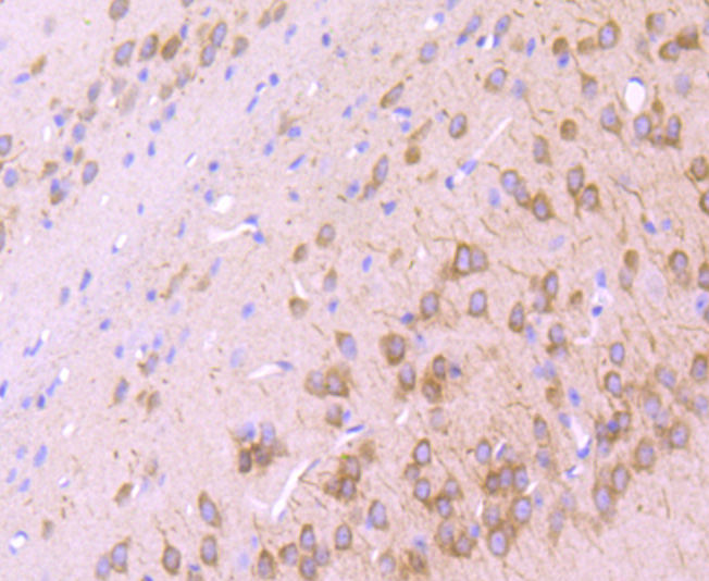 IP3 Receptor Antibody