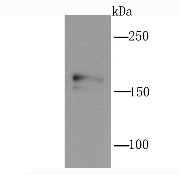 NMDAR2A Antibody