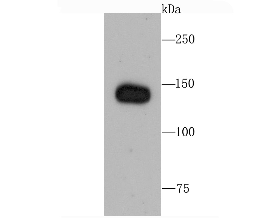 Factor H Antibody