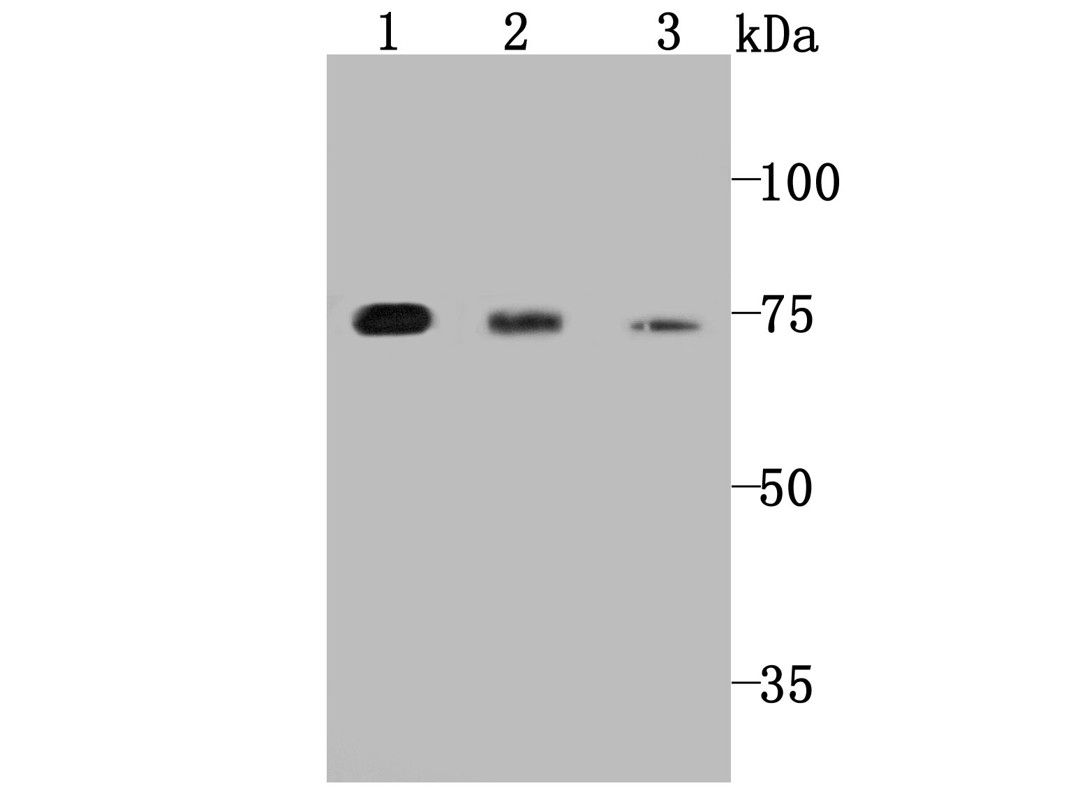 PKC epsilon Antibody