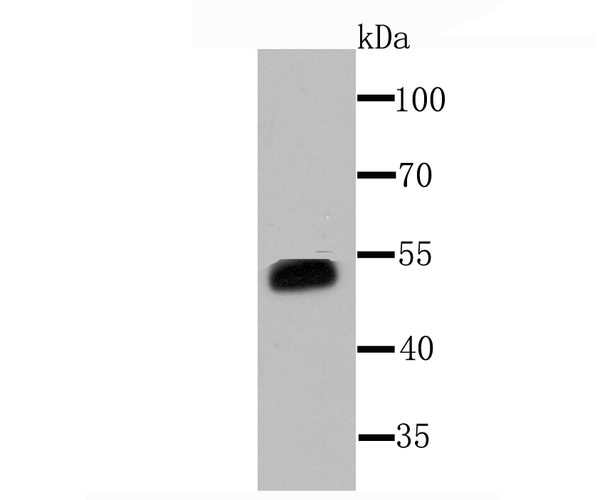 Cytochrome P450 3A4 Antibody