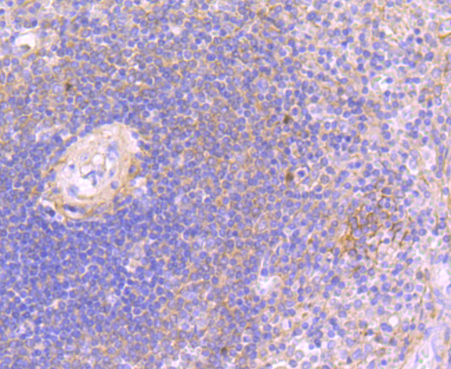 JAK3 Antibody