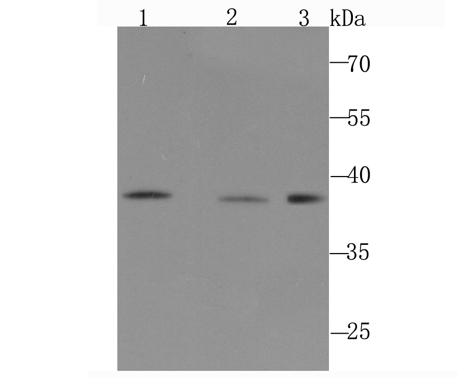 DNA Polymerase beta Antibody