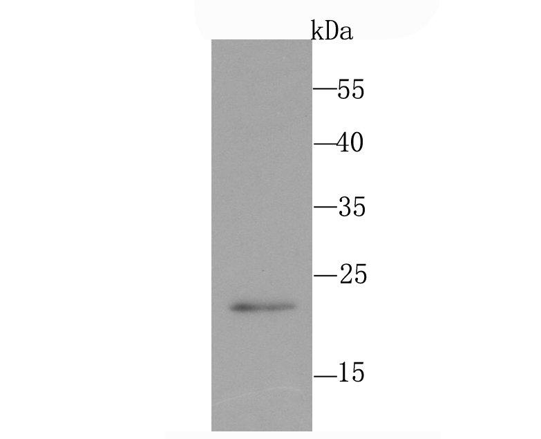 PMP22 Antibody