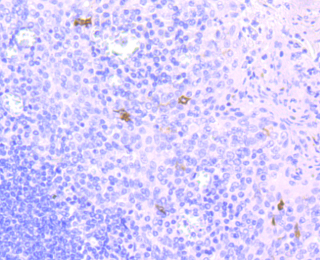 CD1a Antibody
