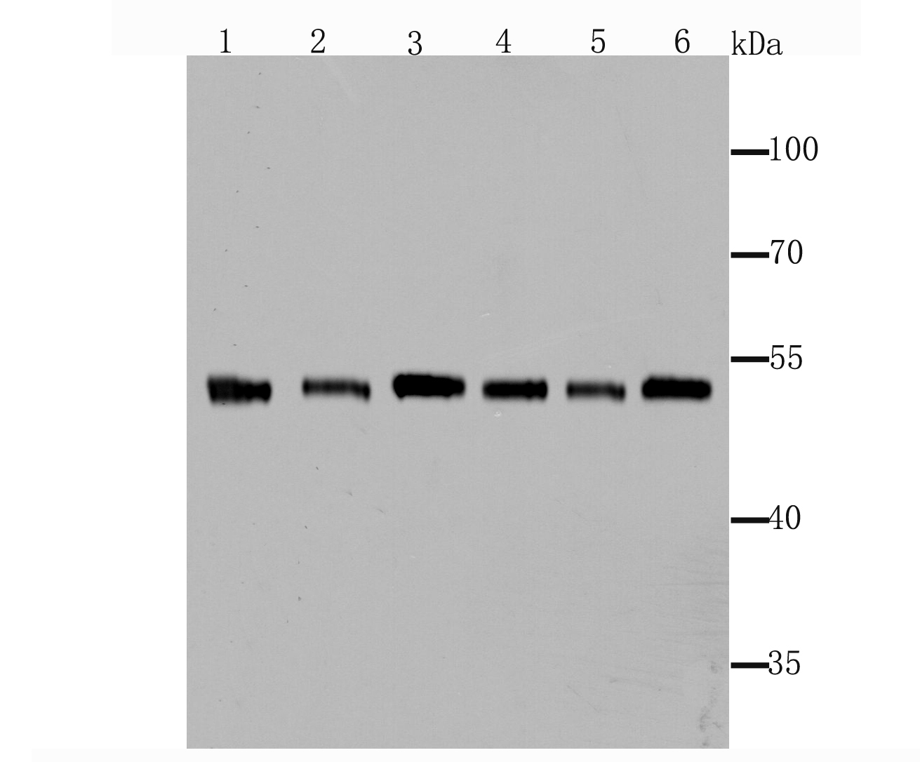 Fascin Antibody