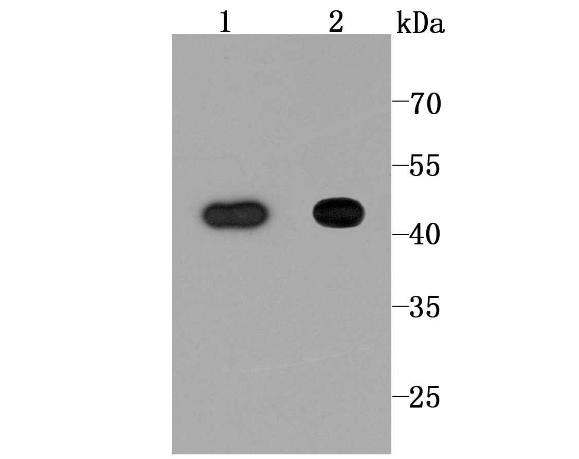 NDRG1 Antibody