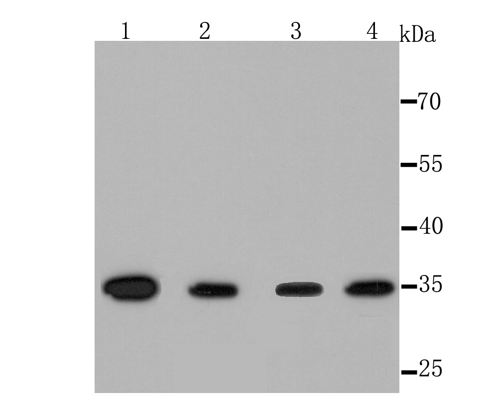 Thymidylate Synthase Antibody