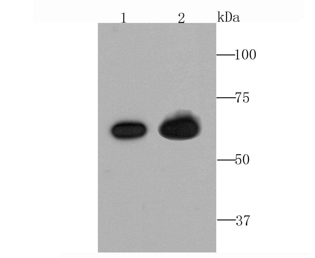 TGFBI Antibody