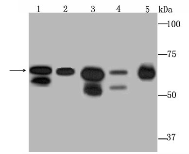 DDX5 Antibody